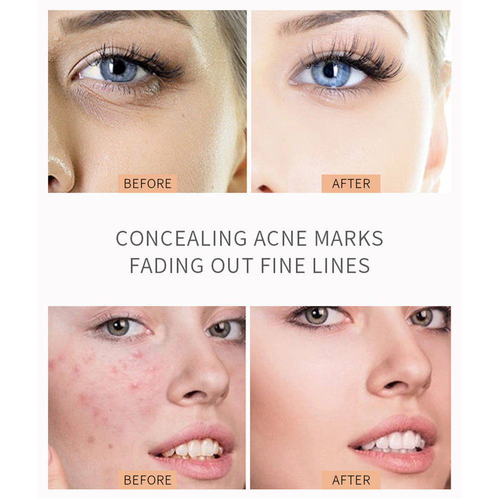 Liquid Concealer Pencil for Spots and Acne Dark Circles