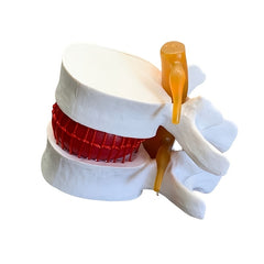 1pc Spine and Disc Model Lumbar Vertebrae Demonstration Teaching Aid
