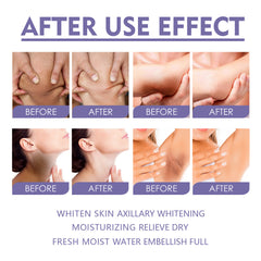Dark Spot Corrector Cream for Underarms Knees Elbows Body Stick