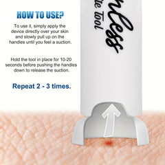 Bug Bite Suction Tool for Outdoor Use