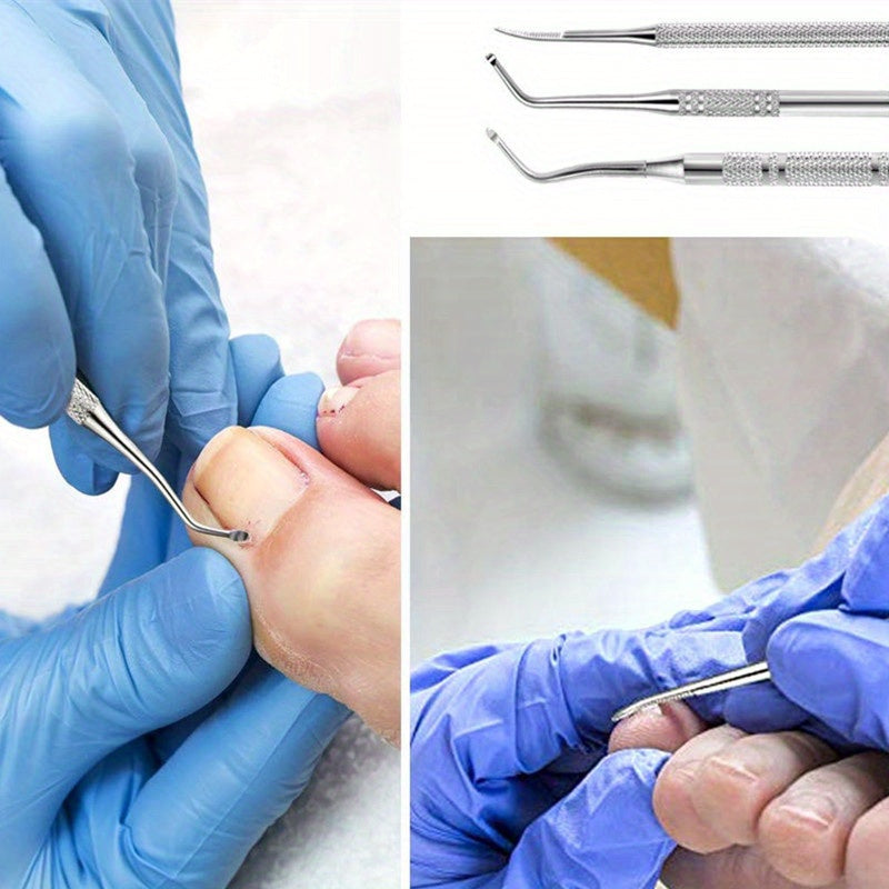 3pcs Ingrown Toenail Removal Tool and File Set Stainless Steel Pedicure Kit