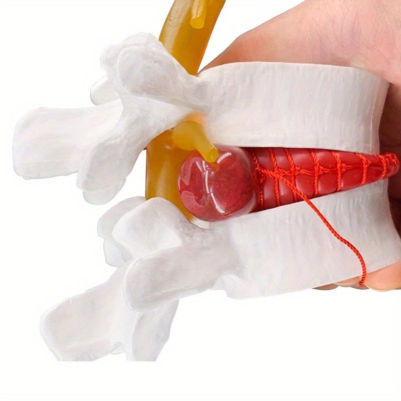 1pc Spine and Disc Model Lumbar Vertebrae Demonstration Teaching Aid