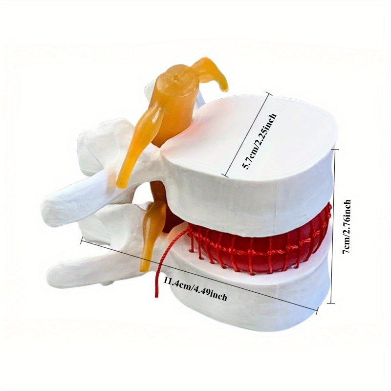 1pc Spine and Disc Model Lumbar Vertebrae Demonstration Teaching Aid