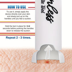 Bug Bite Suction Tool for Instant Relief from Outdoor Bites