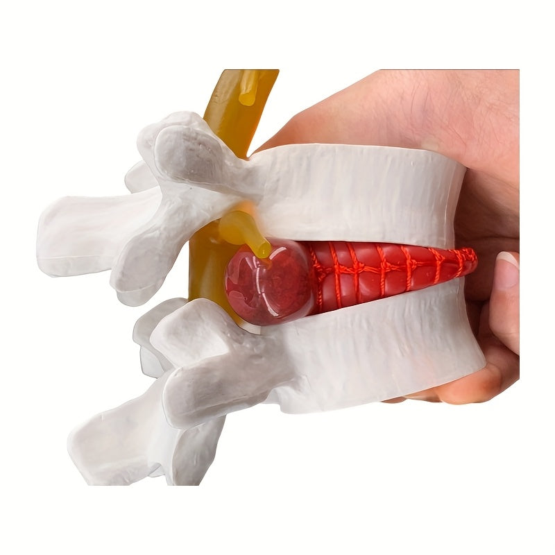 1pc Spine and Disc Model Lumbar Vertebrae Demonstration Teaching Aid