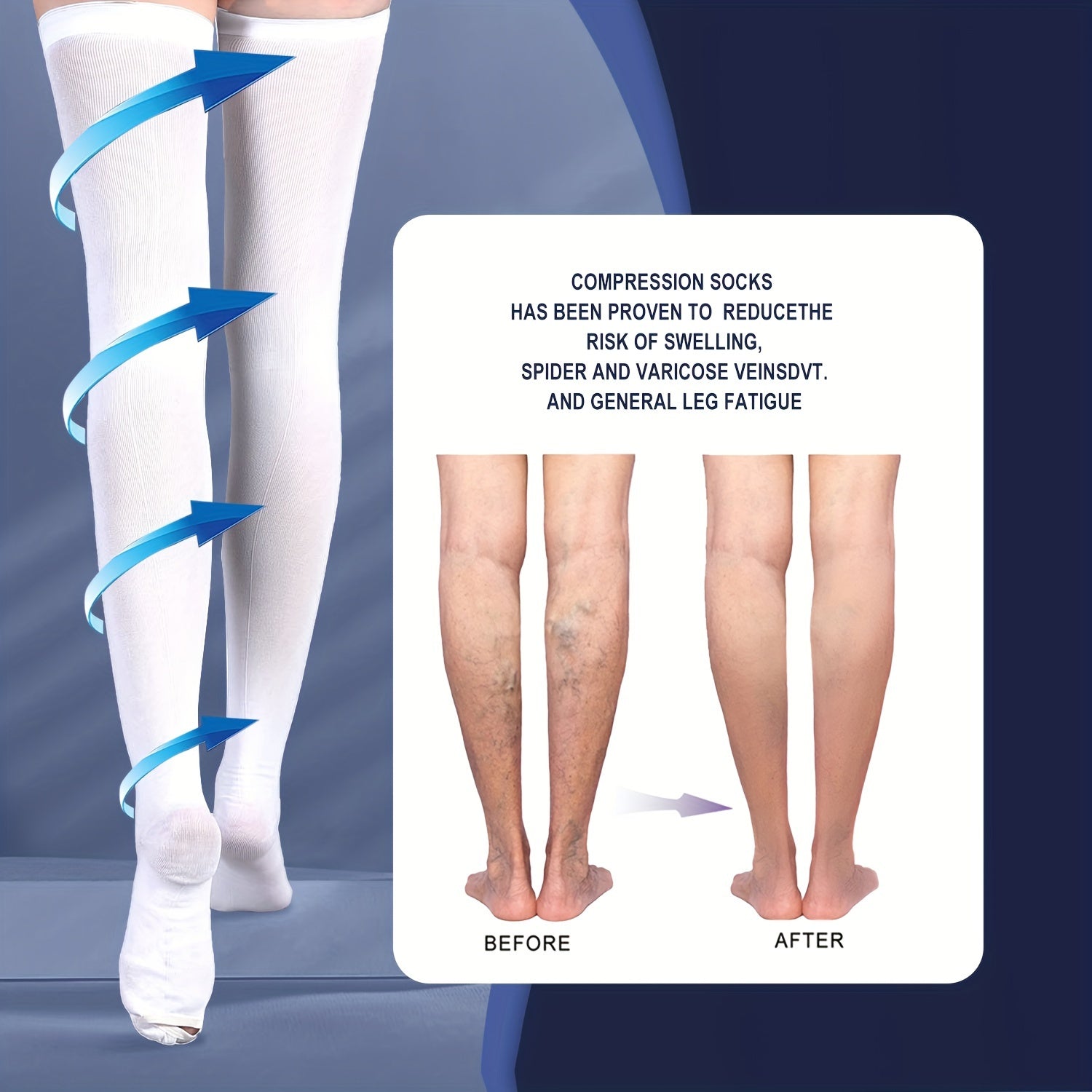 1 Pair Anti Embolism Stockings for Women Men 15 20 mmHg Compression Socks