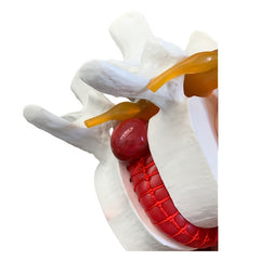 1pc Spine and Disc Model Lumbar Vertebrae Demonstration Teaching Aid