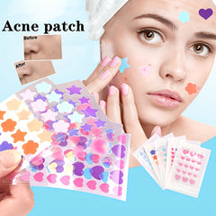 Heart Shape Acne Pimple Patch Spot Stickers