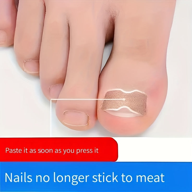 50pcs Ingrown Toenail Corrector Stickers Glue Solution For Toe Nails