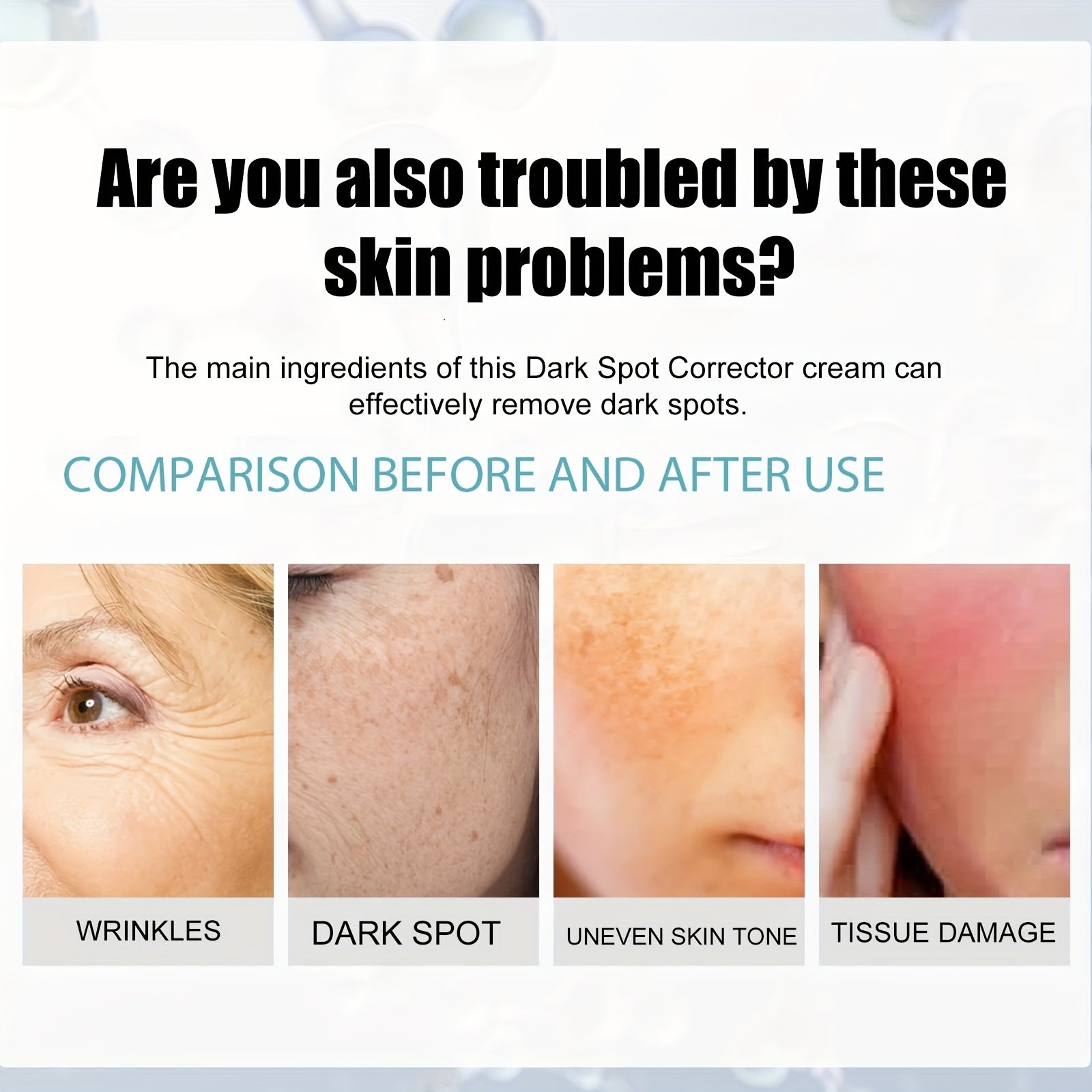 Dark Spot Remover Cream For All Skin Types