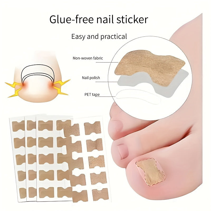 50pcs Ingrown Toenail Corrector Stickers Glue Solution For Toe Nails