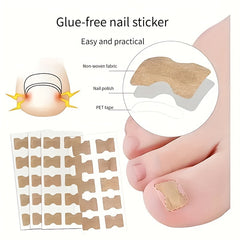 50pcs Ingrown Toenail Corrector Stickers Glue Solution For Toe Nails