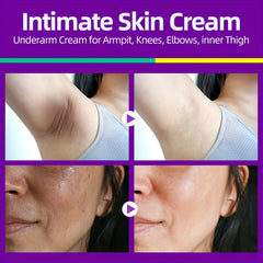 Dark Spot Removal Cream with Vit E & Niacinamide 50ml
