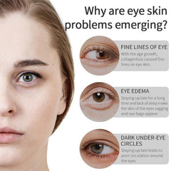 Banana Moisturizing Eye Serum for Eye Bags & Fine Lines