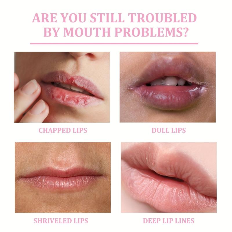 Hydrating Lip Exfoliation Scrub to Fade Lines & Moisturize - Lip Mask Care