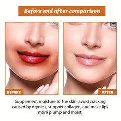 50g Pigmented Spot Lip Care Cream - Moisturizing and Repairing Formula