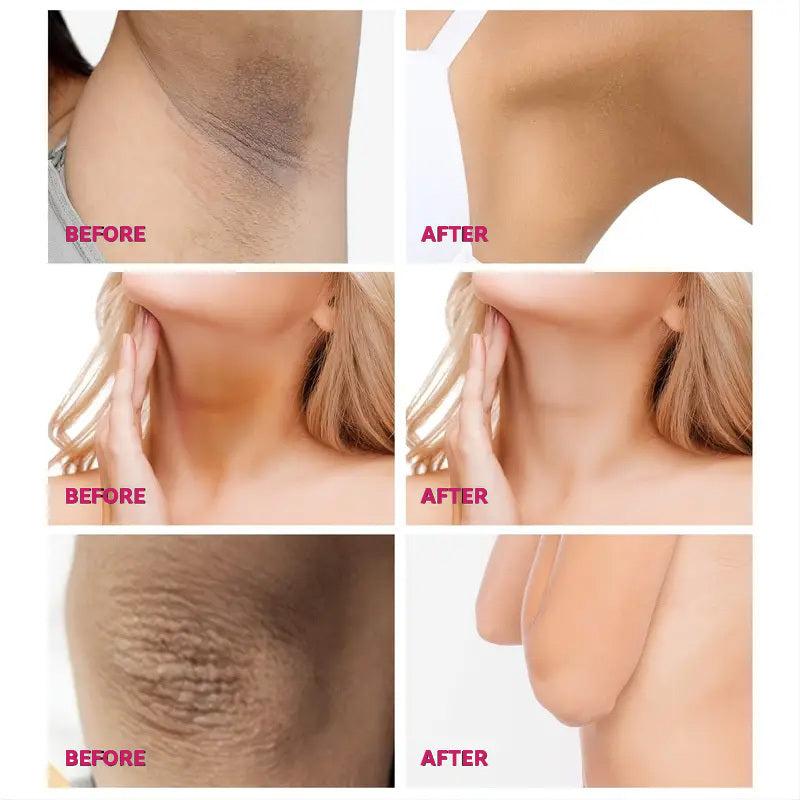 30ml Private Cover Cream - Remove Melanin from Private Areas