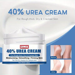 Miracle Foot Cream Repair Dry Cracked Feet Urea 40 & Salicylic Acid 2