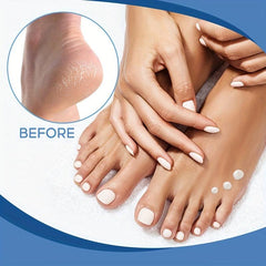 Miracle Foot Cream Repair Dry Cracked Feet Urea 40 & Salicylic Acid 2