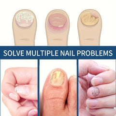 Nail Strengthener Cream Moisturize Nail Bed Soften Nail Cutin