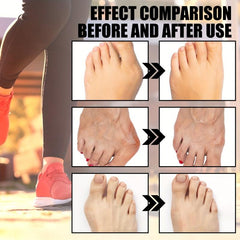 Foot Care Toe Socks Toe Corrector Cushion Invisible Liner Socks
