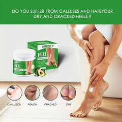 Avocado Heel Balm Moisturizer for Dry Cracked Foot - Hand Foot Care