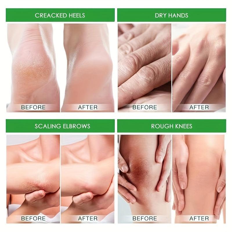 Avocado Heel Balm Moisturizer for Dry Cracked Foot - Hand Foot Care