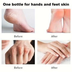 5 Pcs Strawberry Fragrance Hand Cream for Dry Skin, Moisturizing & Nourishing