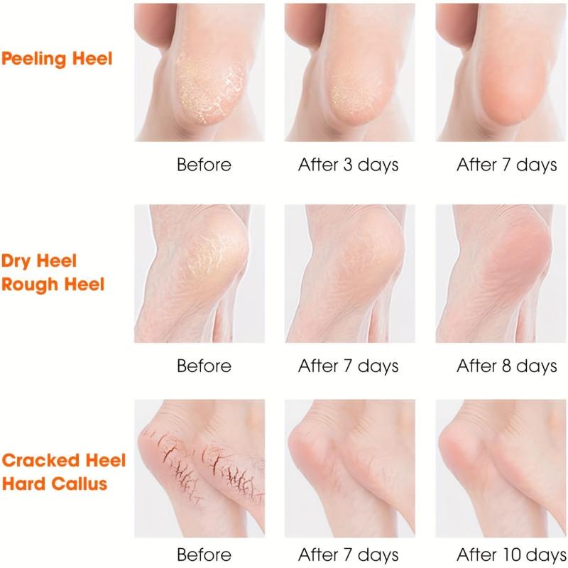 Moisturizing Heel Sleeves Silicone Socks for Women & Men