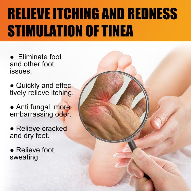 Athlete's Foot Cream for Dry Rough Cracked Skin