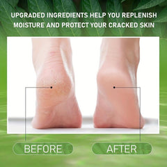 Eucalyptus Foot Cream with Lavender Peppermint Tea Tree - 50g