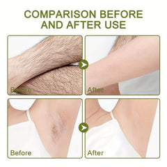 Sumax Sensitive Skin Hair Removal Cream For Women 50ml