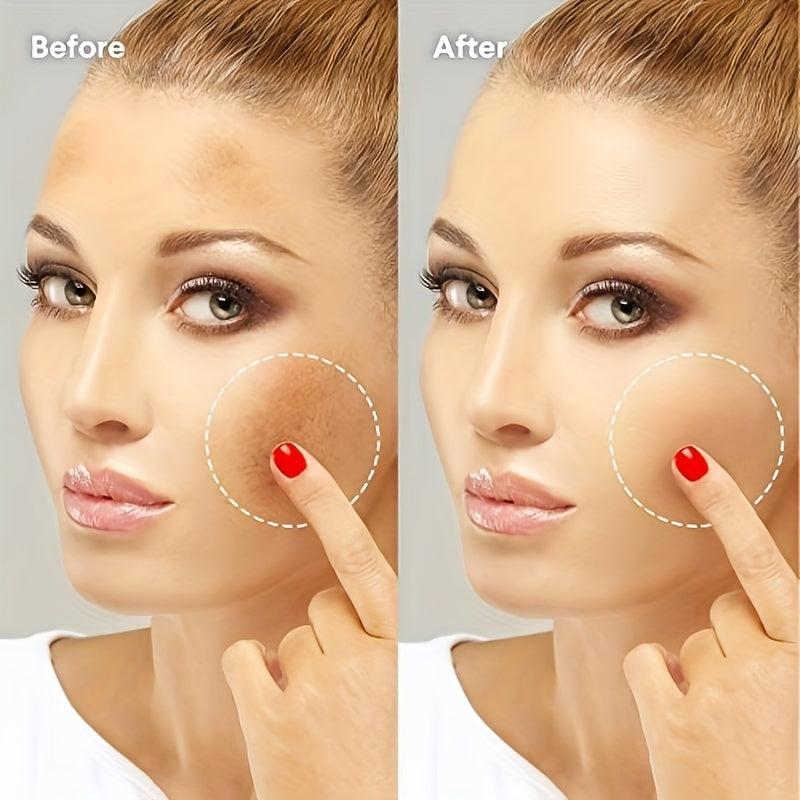 Dark Spot Corrector Cream - Fade Hyperpigmentation, Blemish Cover