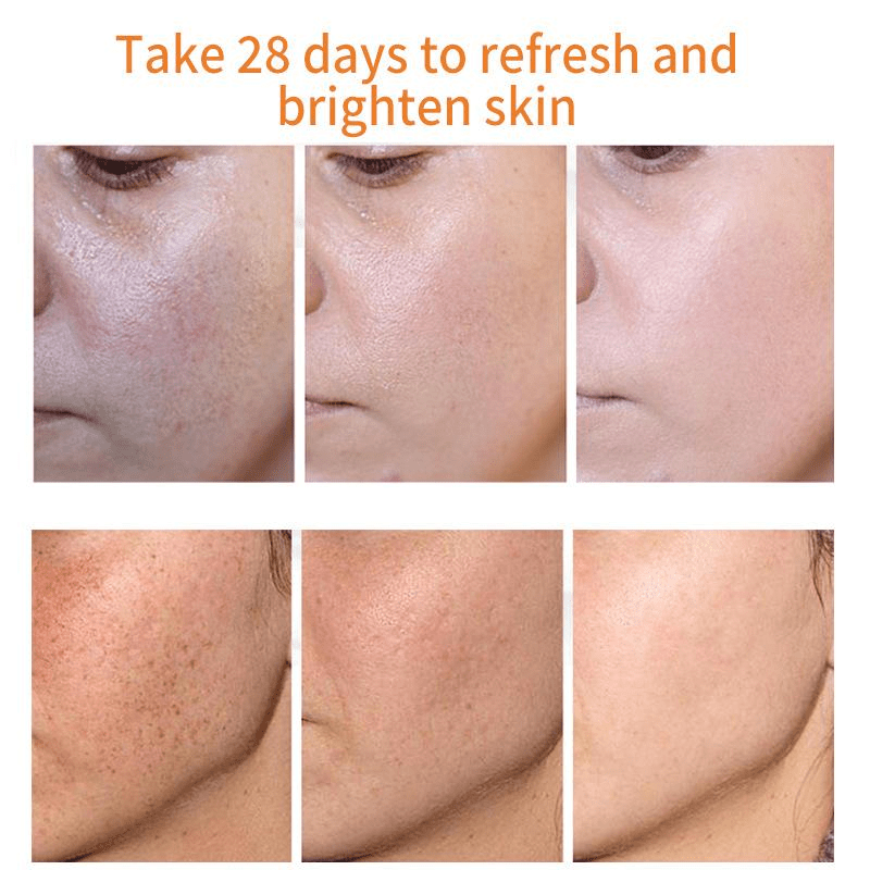 Hydrating Freckle Cream Corrects Dark Spots