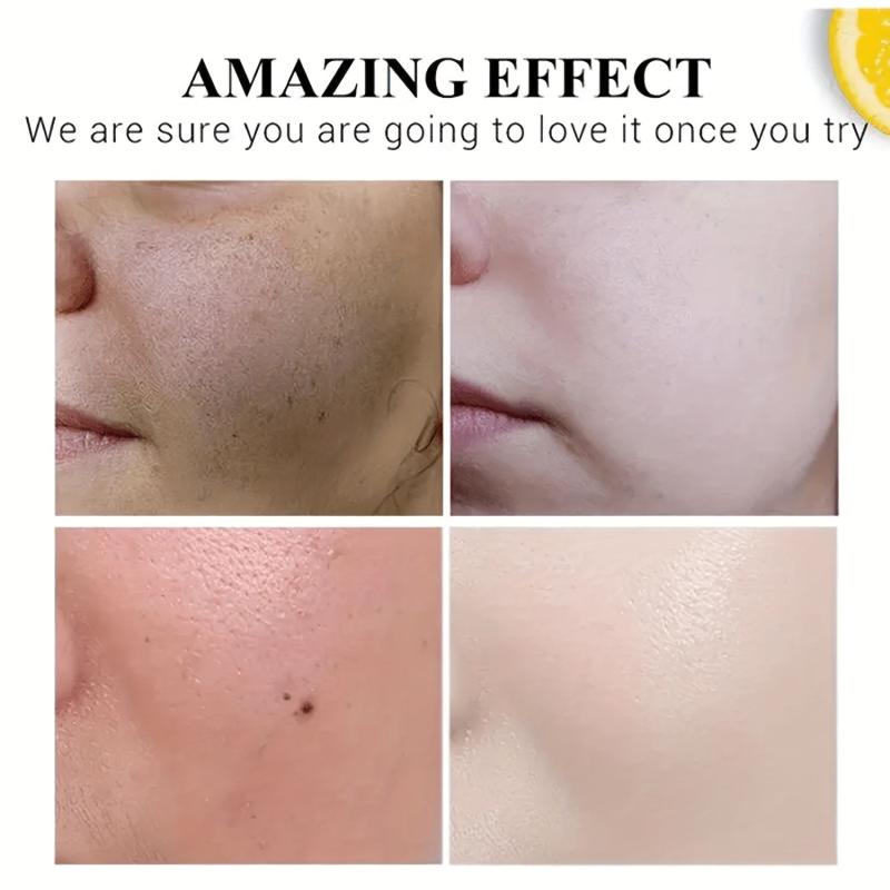Natural Dark Spot Remover For Face And Body Enriching Skin Care