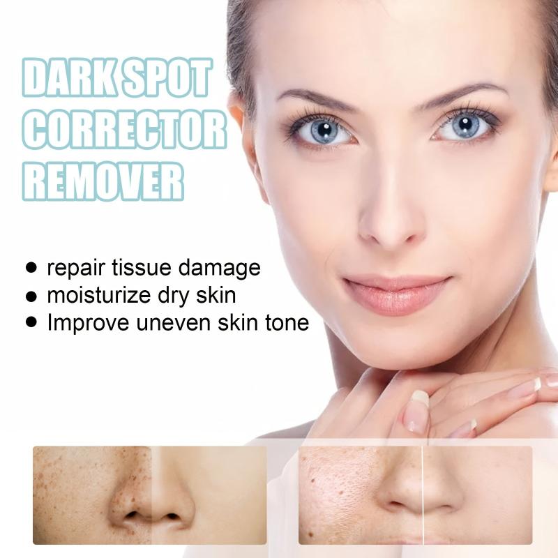 Dark Spot Removal Cream Face Moisturizing Rejuvenation