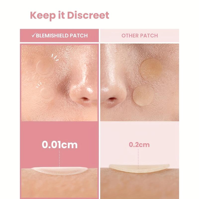 144 Pcs Hydrocolloid Acne Patches - Waterproof Pimple Patches