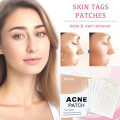 360pcs Hydrocolloid Acne Patch for Acne & Blemishes