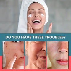 Retinol Cream with Hyaluronic Acid for Aging Skin