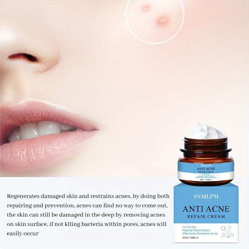 Acne Marks Scars Removal Repair Cream