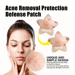 Colorful Acne Patches Tea Tree Portable Invisible Acne Patch