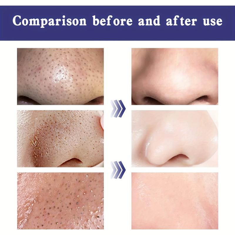 Deep Cleansing Nose Blackhead Pore Tightening Strips
