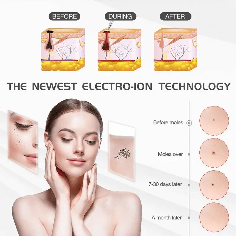 7pcs Laser Plasma Pen Needles for Skin Dark Spot Mole Tattoo Removal