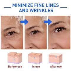 50g Botox Solution Facial Serum Reduce Wrinkles Signs of Aging Moisturizes Skin