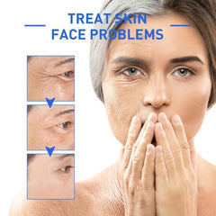 50g Botox Solution Facial Serum Reduce Wrinkles Signs of Aging Moisturizes Skin
