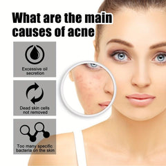 60pcs Colorful Acne Patches Hydrocolloid Spots Blemishes Cover Pimples Zits