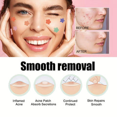 60pcs Colorful Acne Patches Hydrocolloid Spots Blemishes Cover Pimples Zits