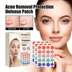 60pcs Colorful Acne Patches Hydrocolloid Spots Blemishes Cover Pimples Zits