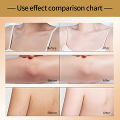 100g Rose Moisturizer for Dry Skin