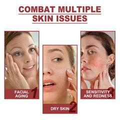 Collagen Eye Mask for Dark Circles - Moisturizing and Firming Eye Rejuvenation